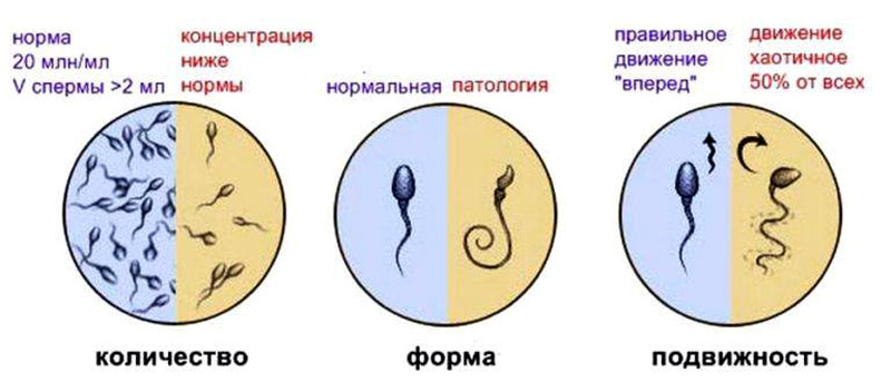 Желеобразная сперма: норма или опасность, причины загустения, лечение